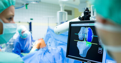 Der Vorteil der Makoplasty: Das Implantat passt sich perfekt dem Knie an – im Gegensatz zu herkömmlichen Verfahren.